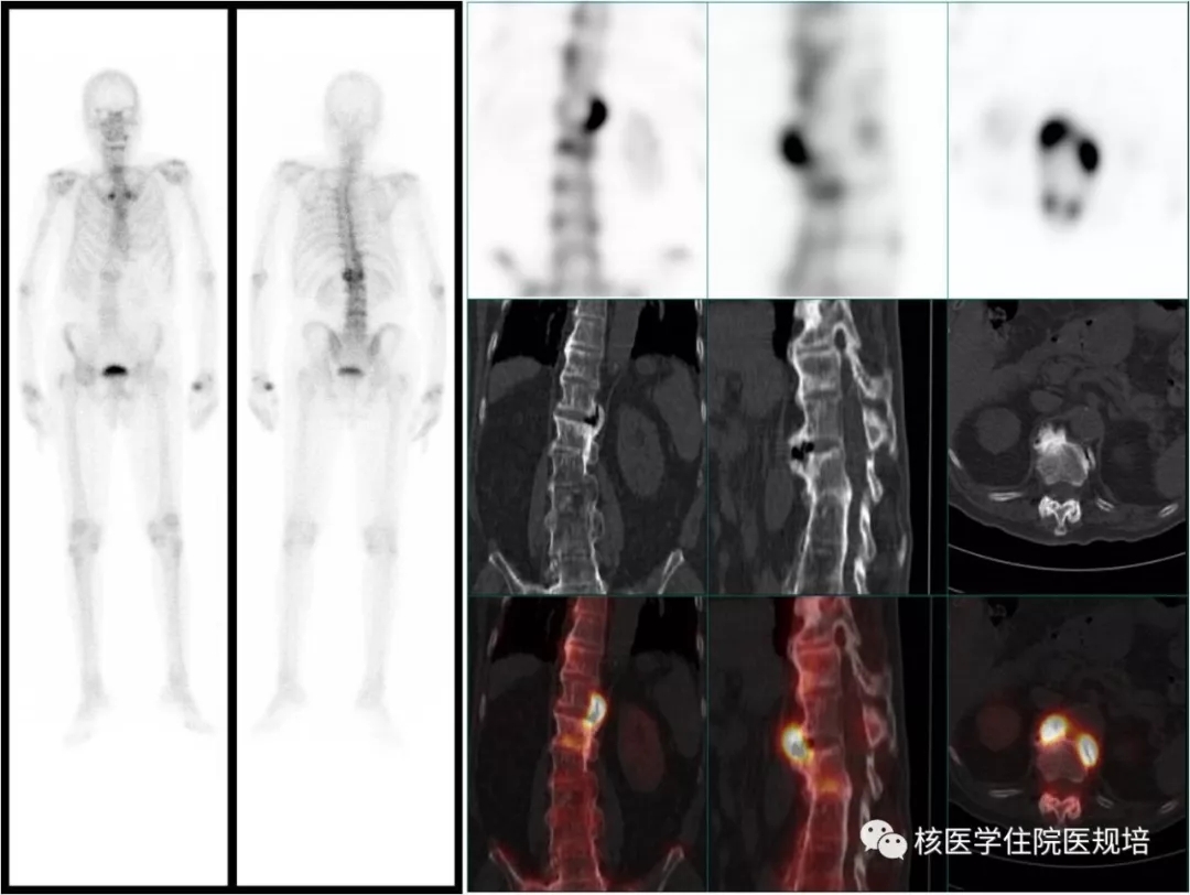 教你看懂自己骨盆问题的X光片分析 - 知乎