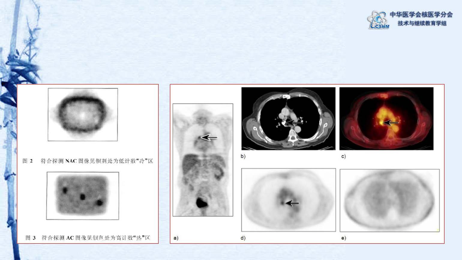 中华医学会核医学分会 讲座 讲座22：PET/CT的图像采集和后处理技术-郑山