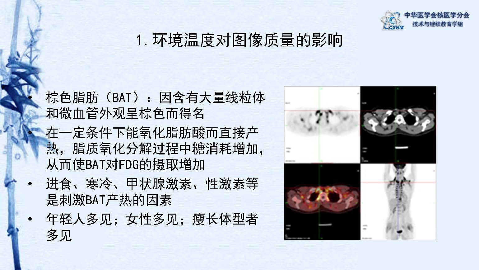 中华医学会核医学分会 讲座 讲座22：PET/CT的图像采集和后处理技术-郑山