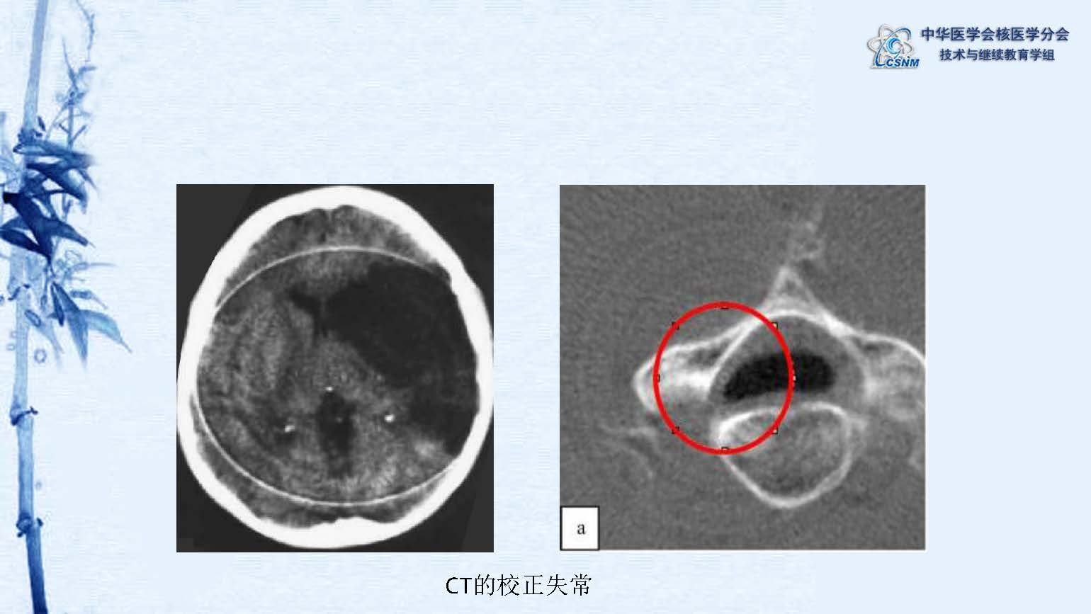 中华医学会核医学分会 讲座 讲座22：PET/CT的图像采集和后处理技术-郑山